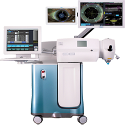 Laser Cataract Surgery